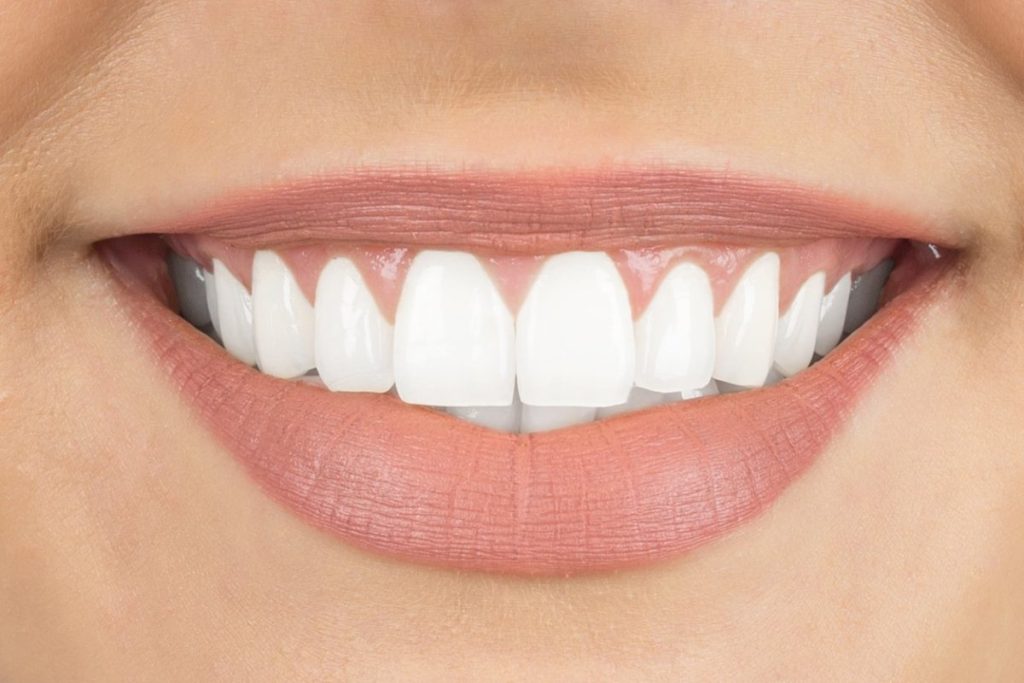 Dental Implants Vista